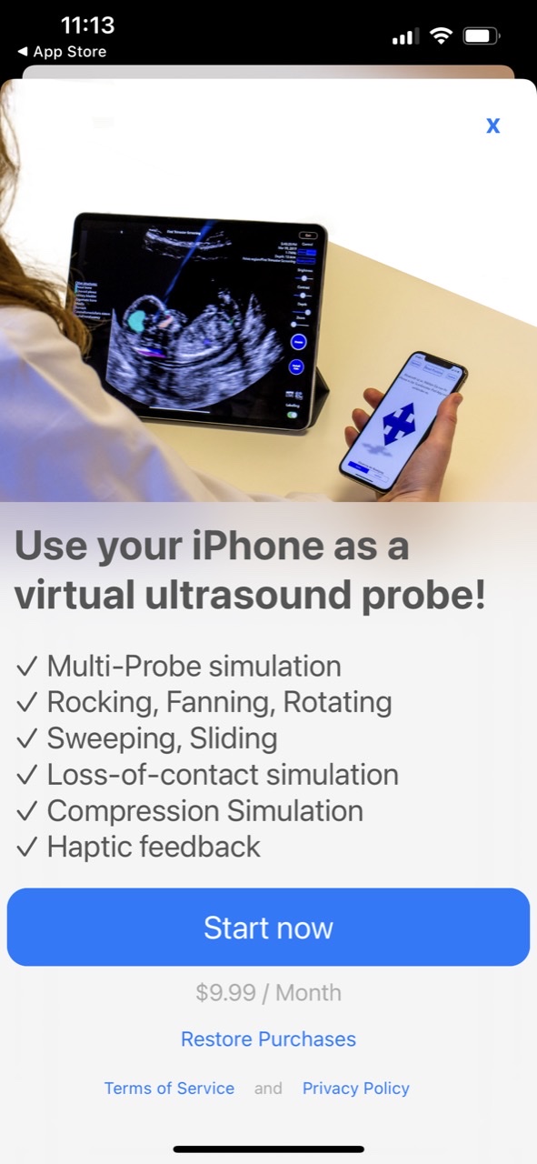 Scanbooster Control sonography