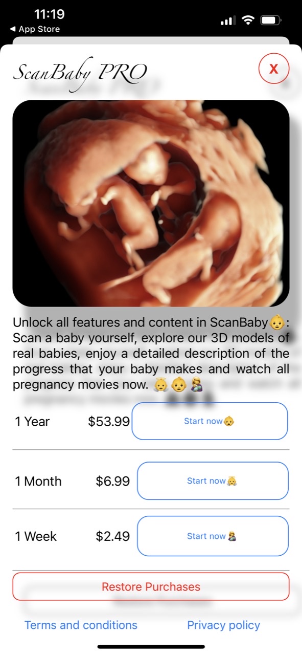 ScanBaby learn baby ultrasound